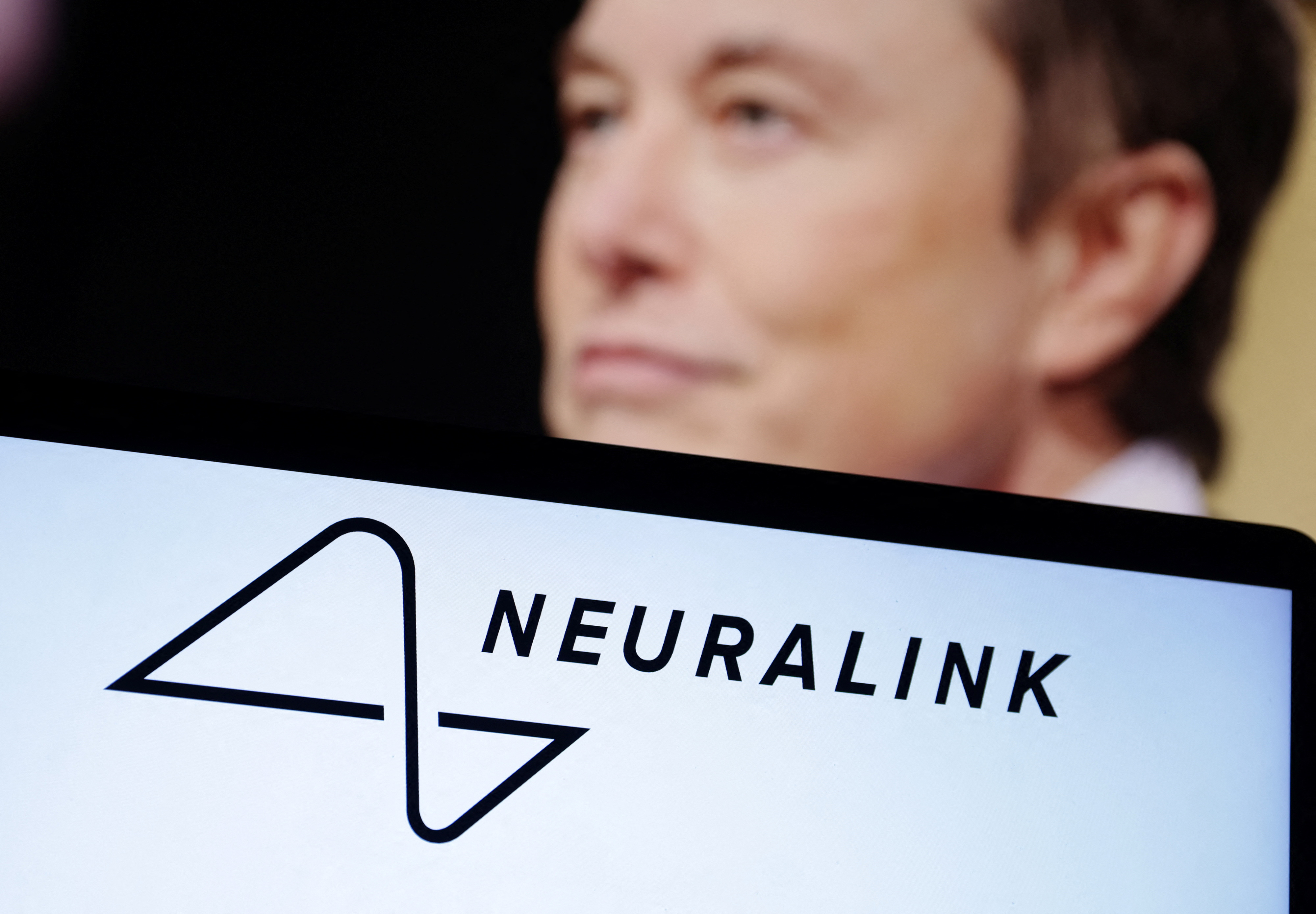 Neuralink của tỷ phú Musk đã lường trước được về sự cố trong ca cấy chip vào não người đầu tiên?